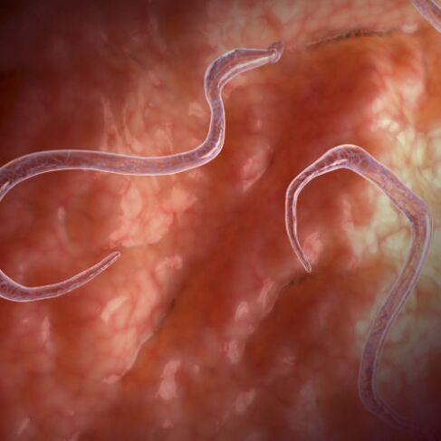 Parasites in the bowels
