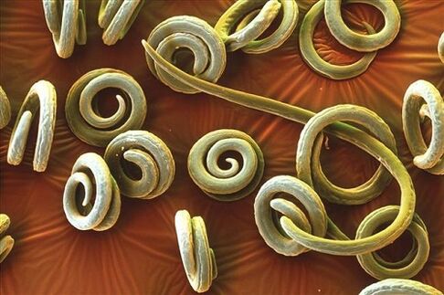 human parasites priquinella