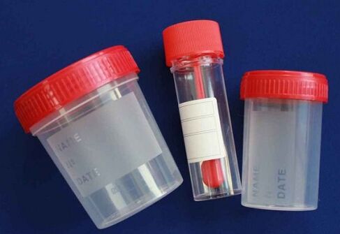 jars to check for parasites